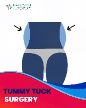 Tummy Tuck Icon
