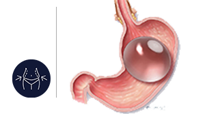 allurion gastric balloon treatments in nairobi