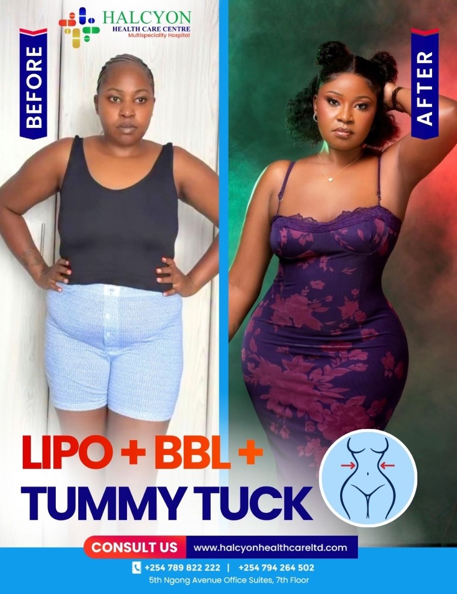 Plastic Surgery Patient Results – Halcyon Hospital Kenya